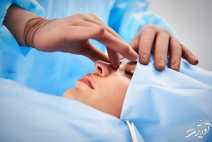 جراحی بینی باز یا بسته ؟ جراحی بینی